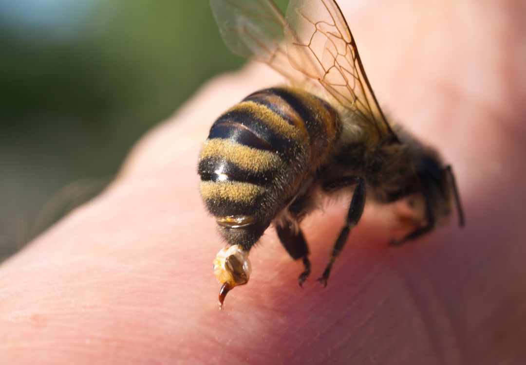 Der Imker-Leitfaden für Bienenstiche